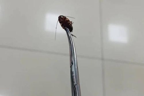 Đang ngủ thấy đau buốt tai, đi khám phát hiện chuyện kinh dị