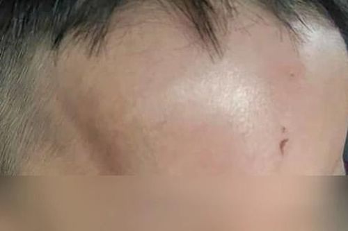 Đà Nẵng xác minh việc phụ huynh tố trẻ bị bạo hành ở trường
