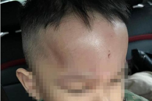 Đà Nẵng: Xác minh thông tin trẻ bị bạo hành ở trường mầm non