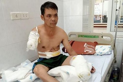 Trao hơn 39 triệu đồng đến ông Thạch Văn Cường bị bỏng điện