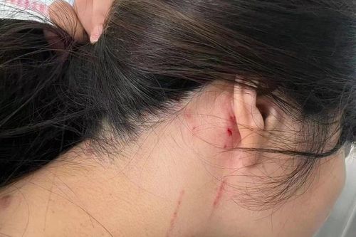Cô gái Trung Quốc bị đánh đập vì từ chối đi xem mắt