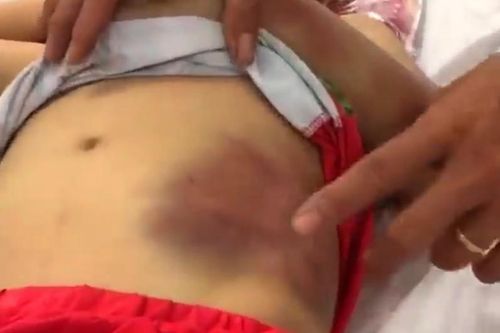 Bắt khẩn cấp 'bảo mẫu' bạo hành, khiến bé trai 6 tháng tuổi dập não