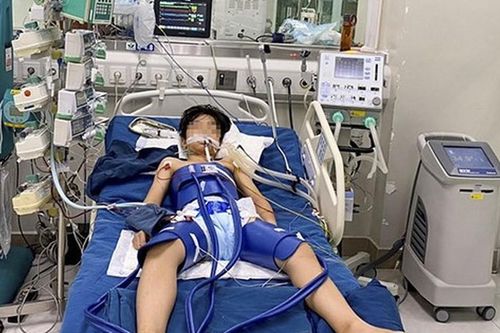 Thiếu niên 12 tuổi đột ngột ngừng tim sau một pha bắt bóng