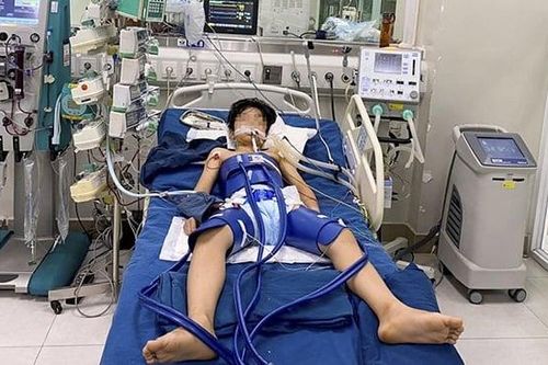 Cứu sống ngoạn mục bé trai bị đột ngột ngừng tim sau một pha bắt bóng