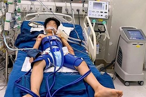 Kỳ tích: Cứu sống bé trai ngừng tim 60 phút sau khi bị sút bóng trúng ngực