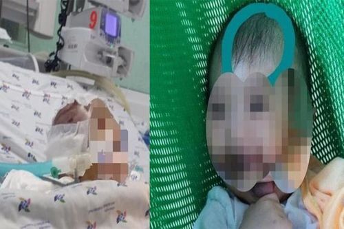 Hội Bảo vệ quyền trẻ em TPHCM lên tiếng vụ bé 6 tháng tuổi bị bạo hành