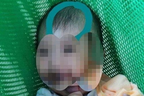Cập nhật tình trạng sức khỏe của bé trai 6 tháng tuổi bị bảo mẫu đánh dập não