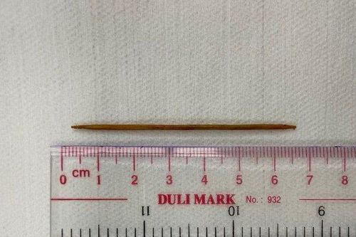 Thói quen khiến người đàn ông bị tăm tre nhọn đâm xuyên tĩnh mạch chủ