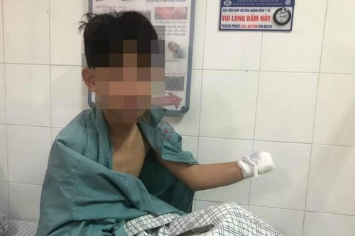Cảnh báo gia tăng tai nạn do sử dụng pháo nổ dịp Tết