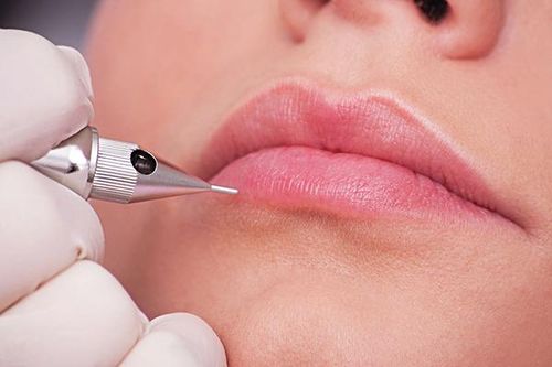Đóng vảy, nứt nẻ sau xăm môi làm đẹp đón Tết