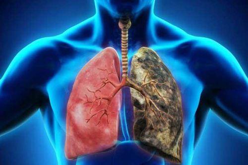 5 loại ung thư nguy hiểm có tính di truyền qua nhiều đời, đề phòng với những dấu hiệu 'quen mặt' này
