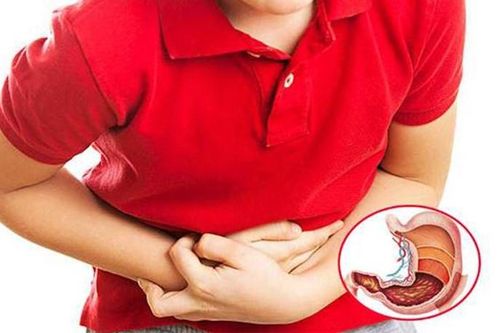 Mẹo giúp tránh cơn đau dạ dày bùng phát vào dịp Tết
