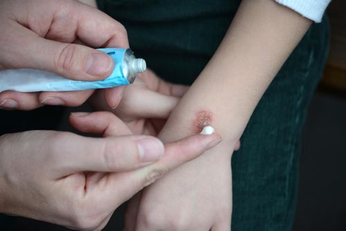 7 sai lầm khi sơ cứu chấn thương cho trẻ nhỏ ngày Tết