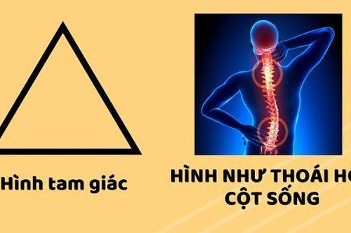 Kỳ nghỉ Tết sắp hết, đã đến lúc bắt tay 'giải cứu' cột sống Gen Z trước những deadline!