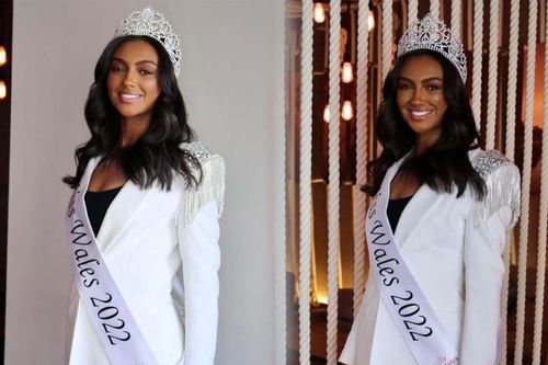Thí sinh Miss World gặp tai nạn trước thềm tham gia thi đấu: Xót xa cho gương mặt xinh đẹp