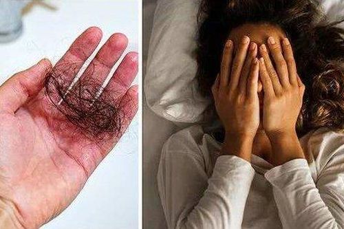 Chuyên gia cảnh báo thói quen làm tăng nguy cơ rụng tóc, khiến vi khuẩn phát triển