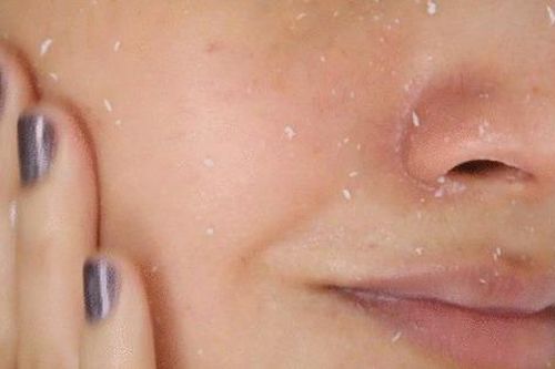 Cách khắc phục khi bị vón cục mỹ phẩm do silicone trên da