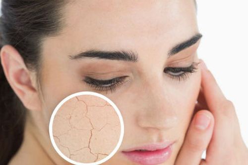 Dấu hiệu cơ thể bị thiếu nước trầm trọng