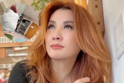Vừa đầu năm mới, một nữ ca sĩ gặp tai nạn, một mình lái xe vào viện