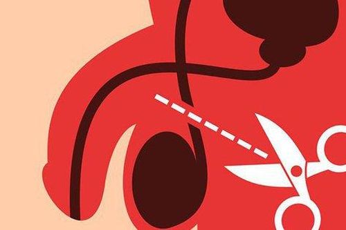 Triệt sản làm giảm ham muốn ở nam giới?