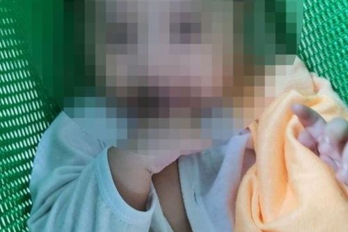 Bé 6 tháng tuổi bị bảo mẫu bạo hành vẫn hôn mê sâu