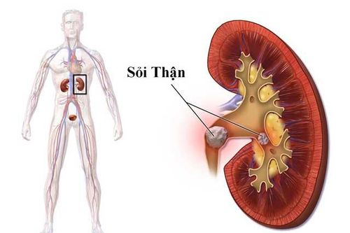 Nếu có dấu hiệu này chắc chắn bạn đang mắc bệnh rất nặng về thận, đừng chần chừ hãy đi khám bác sỹ ngay