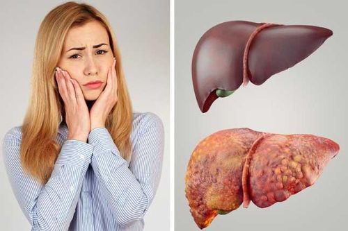 3 cách 'dễ như ăn kẹo' giúp bạn thải độc tố ra khỏi cơ thể đơn giản nhất ai cũng làm được