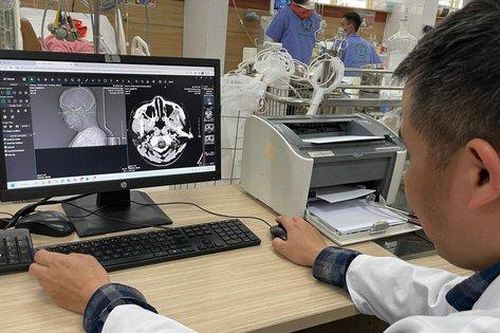 Nhiều người trẻ nhồi máu não, hôn mê, suy thận cấp... sau bữa rượu 'không say không về'