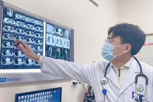 Lóc động mạch chủ - nguy cơ đột tử cao