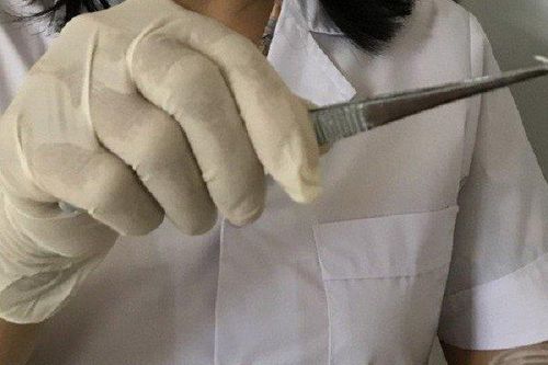 Thấy ngứa da, người đàn ông 42 gãi ra con giun dài 7cm