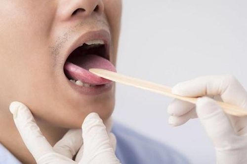 Tê lưỡi có thể là dấu hiệu của nhiều bệnh nguy hiểm