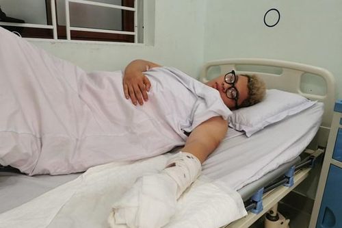 Nghi 'nhìn đểu' nam thanh niên Hải Phòng bị chém đứt 2 ngón tay