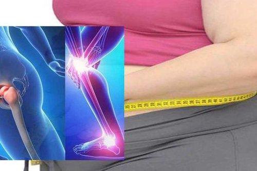 Người bị thoái hóa khớp kèm theo béo phì có nguy cơ gặp những biến chứng gì?