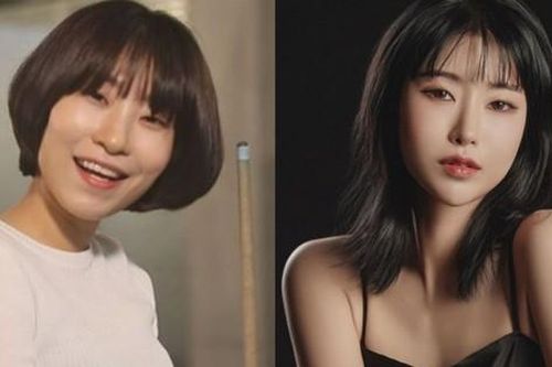 Nữ diễn viên thay đổi gương mặt vì bị chê xấu