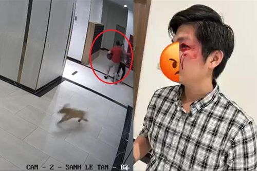 Bảo vệ bé trai khỏi chó dữ, thanh niên bị đấm 'nát mặt'