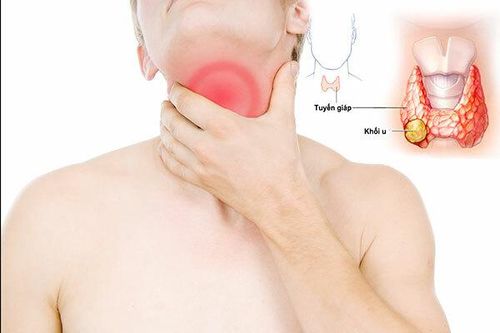Vì sao ung thư tuyến giáp ngày càng gia tăng?