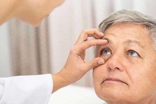 Bệnh Basedow có chữa được không?