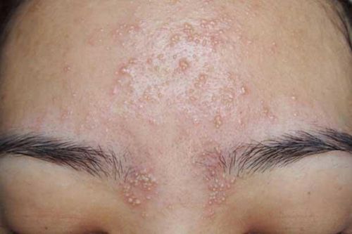 Nếu trả lời 'có' 6 câu hỏi này, thận của bạn đã nhiễm độc nặng, hãy đi khám ngay trước khi quá muộn