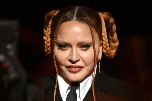 Gương mặt của Madonna gây bàn tán