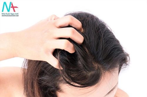 Nguyên nhân gây gàu, nấm tóc và cách xử lý
