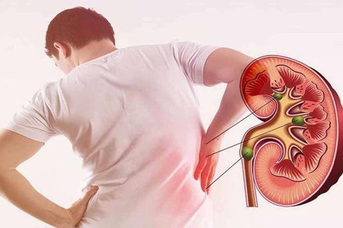 Triệu chứng suy thận sớm cần đặc biệt chú ý