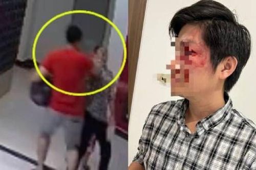 UBND TP.HCM yêu cầu xử lý nghiêm vụ chủ chó đánh người gây thương tích
