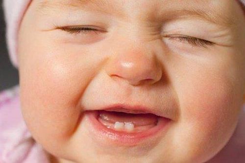 Bệnh viêm lợi ở trẻ em do nguyên nhân nào?