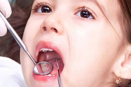Viêm nha chu ở trẻ em