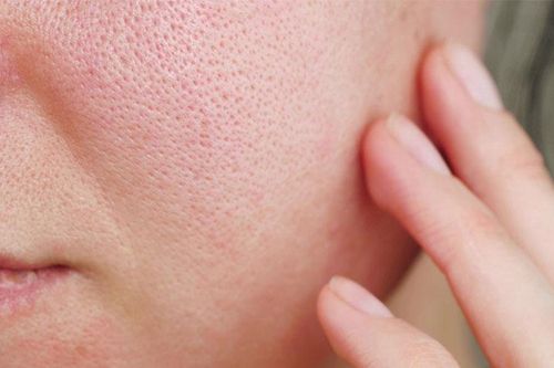Cách làm đá viên hoa hồng thu nhỏ lỗ chân lông
