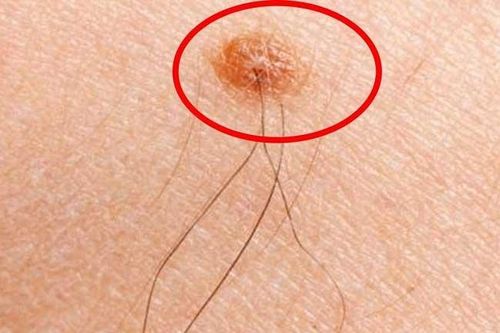 5 dấu hiệu nhiều người gặp cứ lầm tưởng bản thân đang bị ung thư nhưng thực tế lại thế này