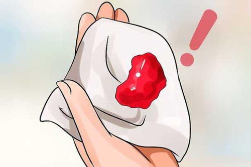 Chỉ một dấu hiệu này, nhiều chị em đi khám bất ngờ phát hiện mang 'án tử ung thư'