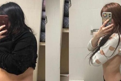 Cô gái Hàn Quốc giảm 75kg chia sẻ tác hại từ giảm cân tiêu cực