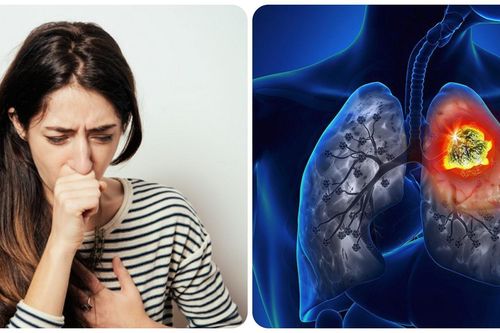 Triệu chứng ung thư phổi giai đoạn đầu hay bị nhầm lẫn với bệnh khác