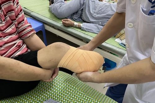 Người đàn ông bị cắt bàn chân vì chủ quan với vết bầm tím nhỏ